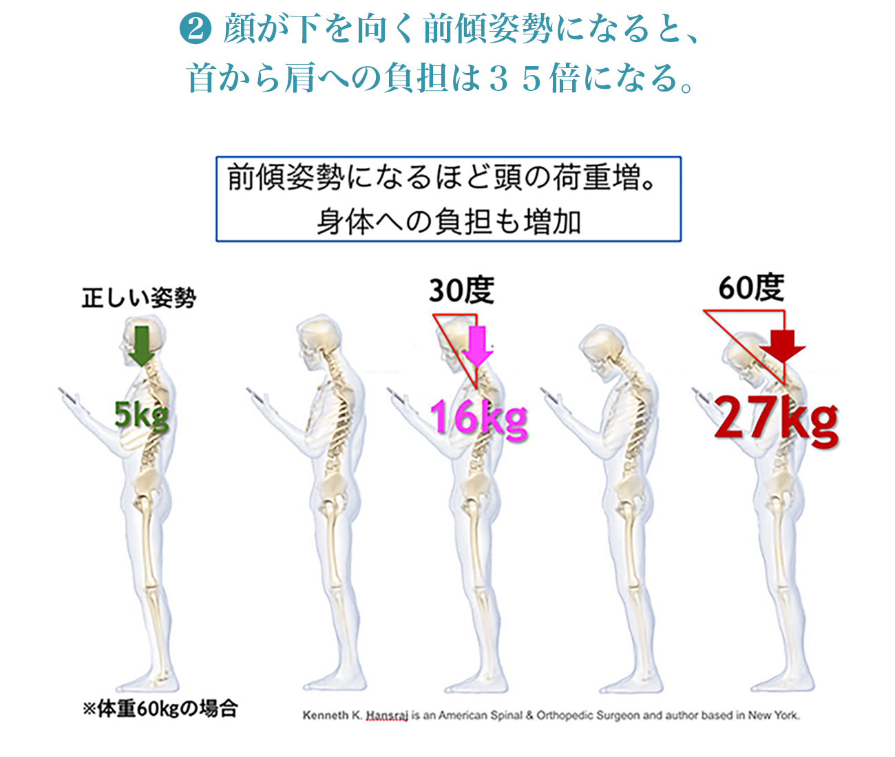 前傾姿勢の身体への負担